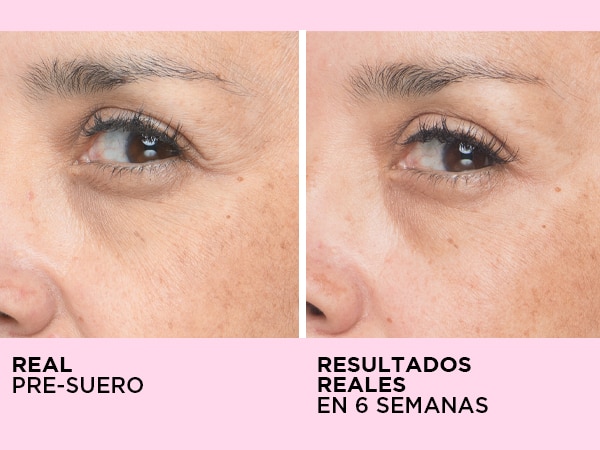 anticaida