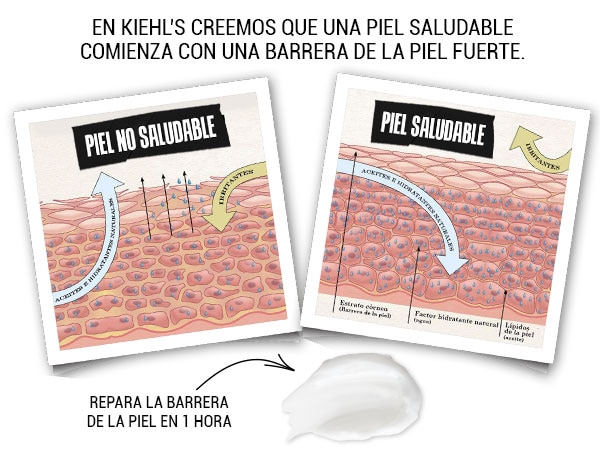 anticaida