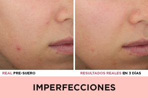 ”suero"