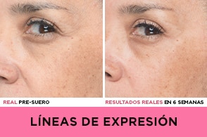rostro