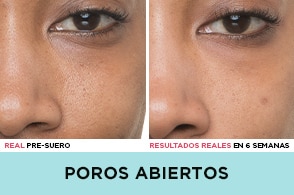 ”ojos"