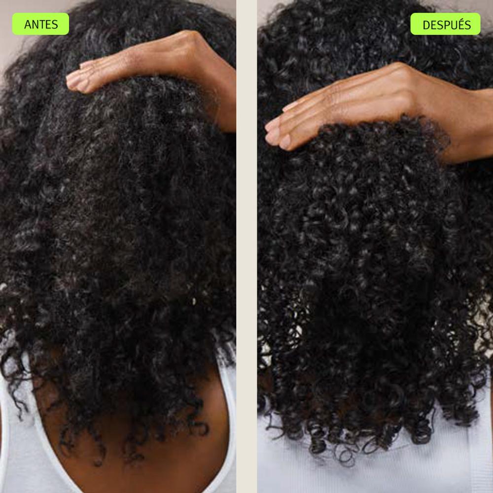 HOLIDAY SET SCALP SOLUTIONS (SET DE CUIDADO DE CUERO CABELLUDO)