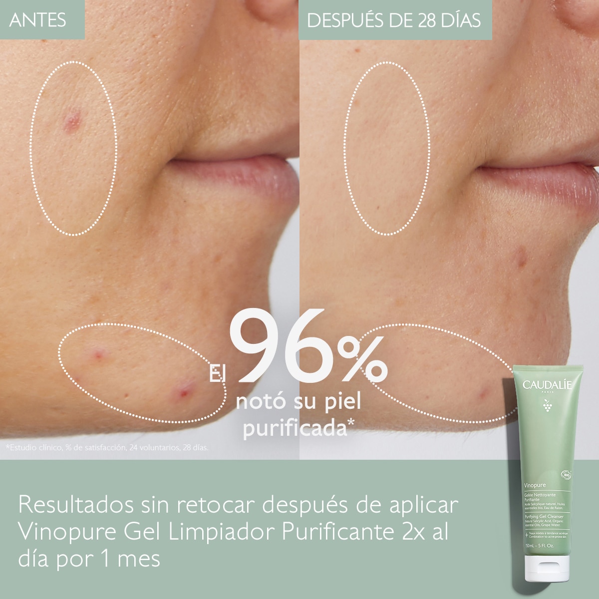 VINOPURE PORE PURIFYING GEL CLEANSER (GEL LIMPIADOR PURIFICANTE)