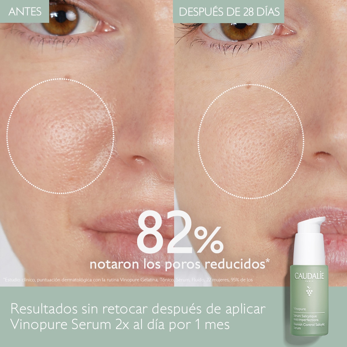 VINOPURE NATURAL SALICYLIC ACID PORE MINIMIZING SERUM