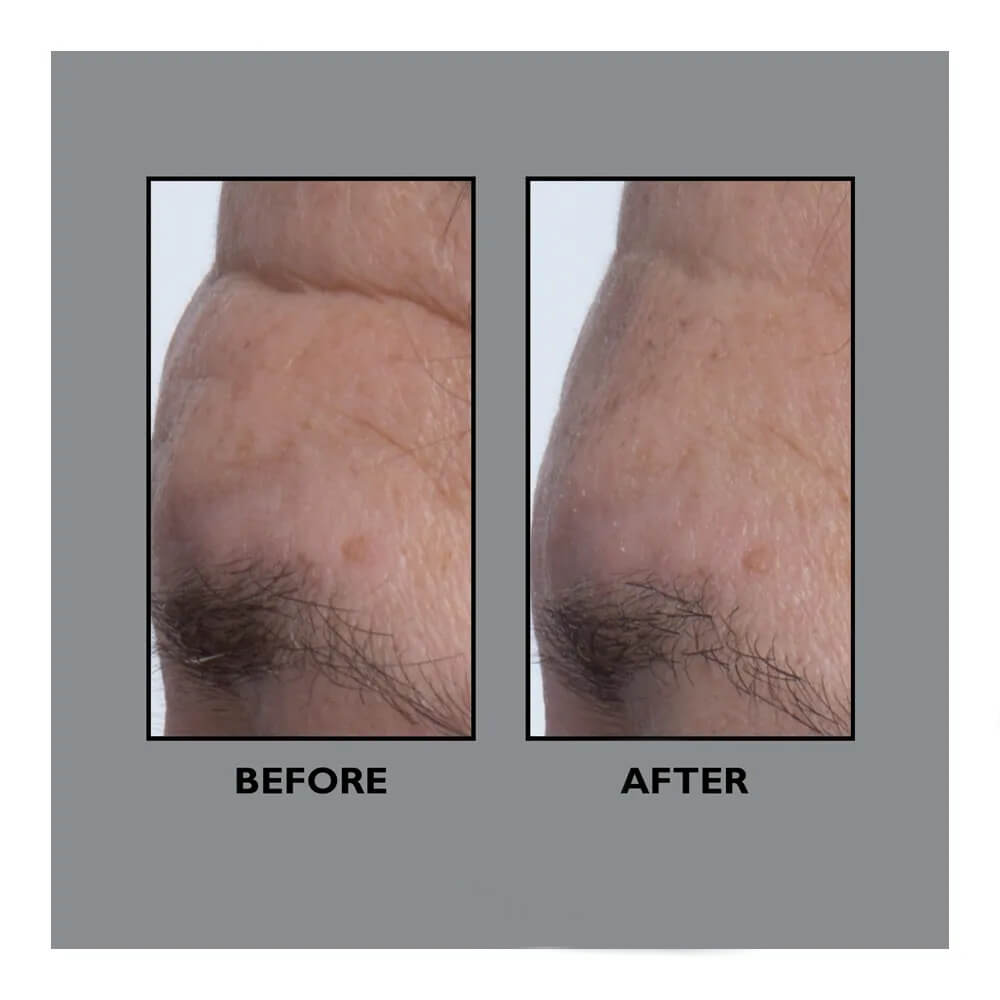 FIRMX® COLLAGEN SERUM 30ML (SUERO FACIAL)
