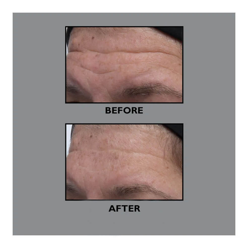 FIRMX® COLLAGEN SERUM 30ML (SUERO FACIAL)