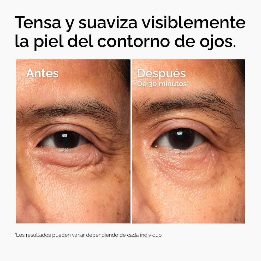 LACTO-PDRN&trade; 4% + B9 EYE CREAM (CREMA PARA EL CONTORNO DE OJOS CON LACTO-PDRN 4% + VITAMINA B9)