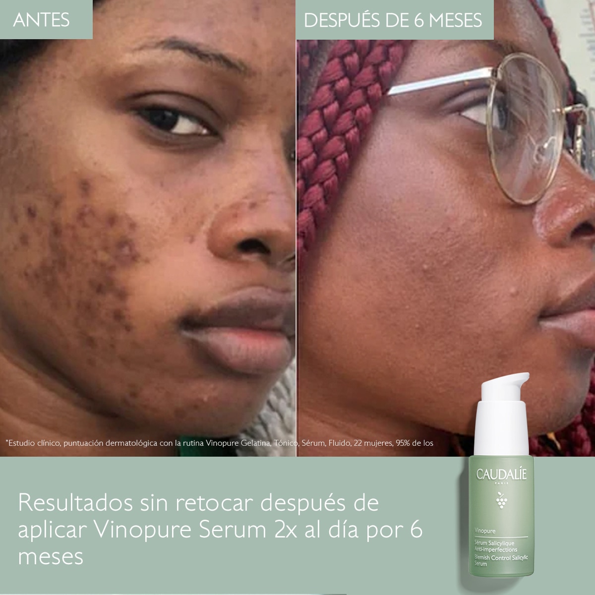 VINOPURE NATURAL SALICYLIC ACID PORE MINIMIZING SERUM