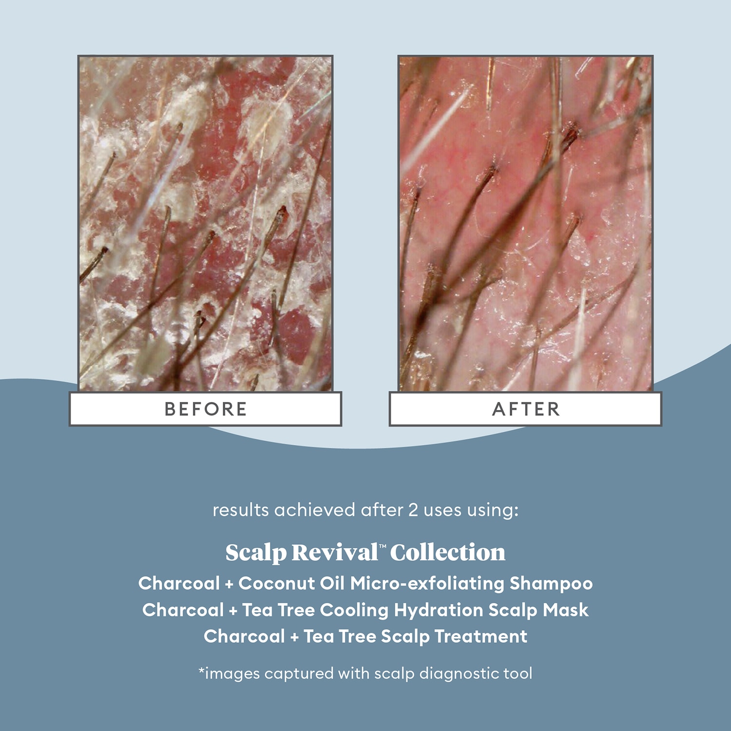 SCALP REVIVAL CHARCOAL + TEA TREE COOLING HYDRATION MASK FOR DRY, ITCHY SCALP (MASCARILLA CAPILAR HIDRATANTE)