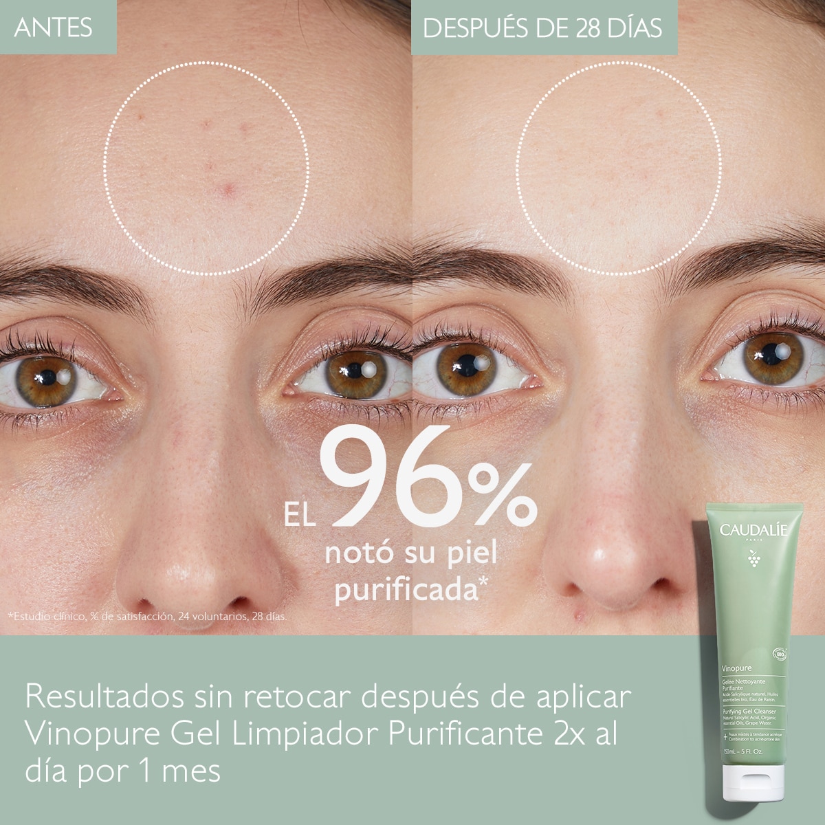 VINOPURE PORE PURIFYING GEL CLEANSER (GEL LIMPIADOR PURIFICANTE)