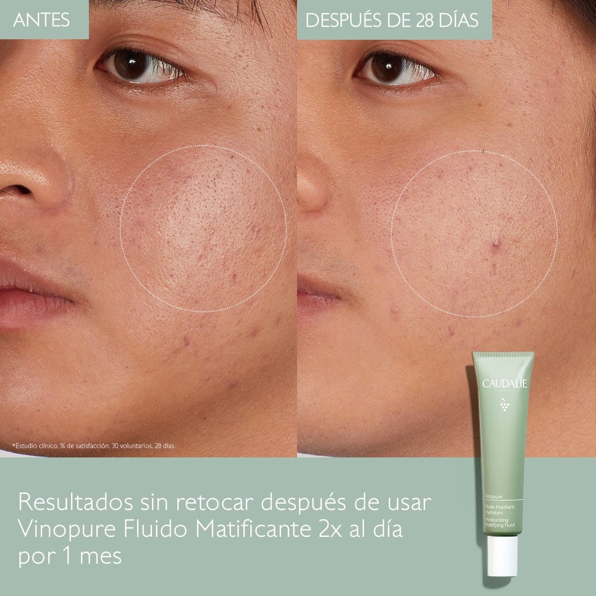 VINOPURE NATURAL OIL CONTROL MOISTURIZER