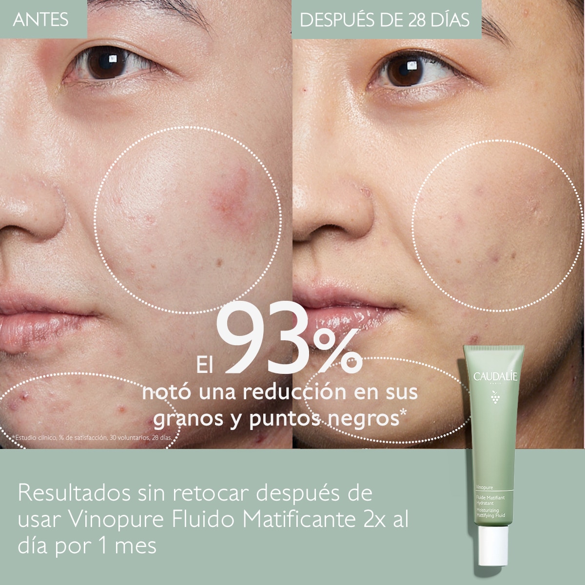 VINOPURE NATURAL OIL CONTROL MOISTURIZER