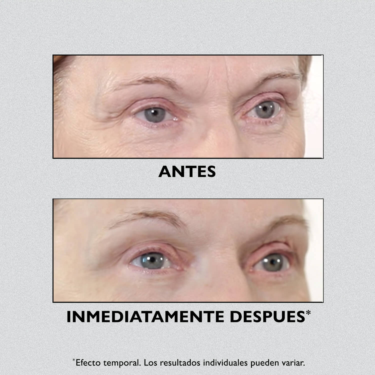 INSTANT FIRMX EYE
