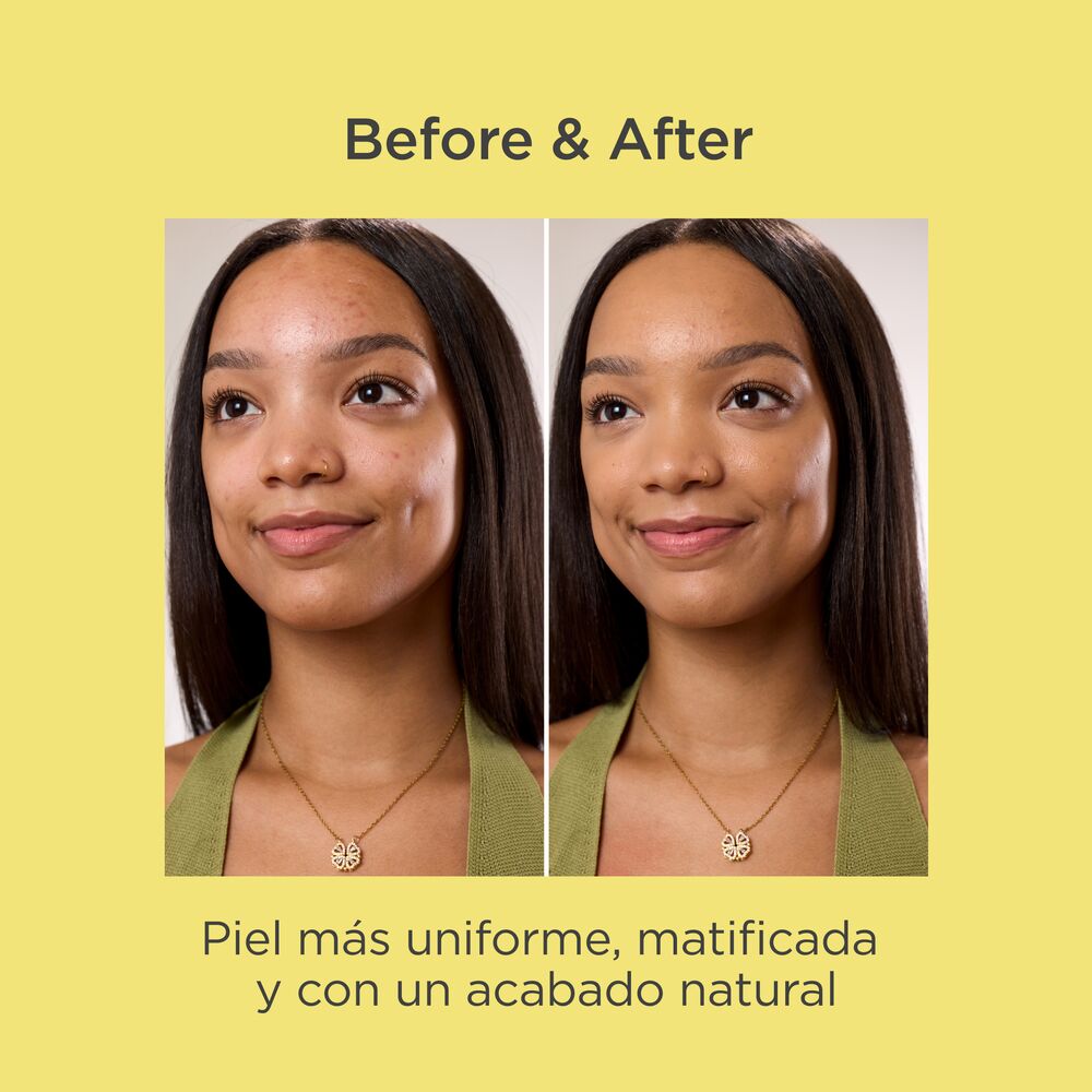 ACNIBEN CC CREAM SPF30 (CREMA HIDRATANTE CON COLOR Y PROTECCI&Oacute;N)