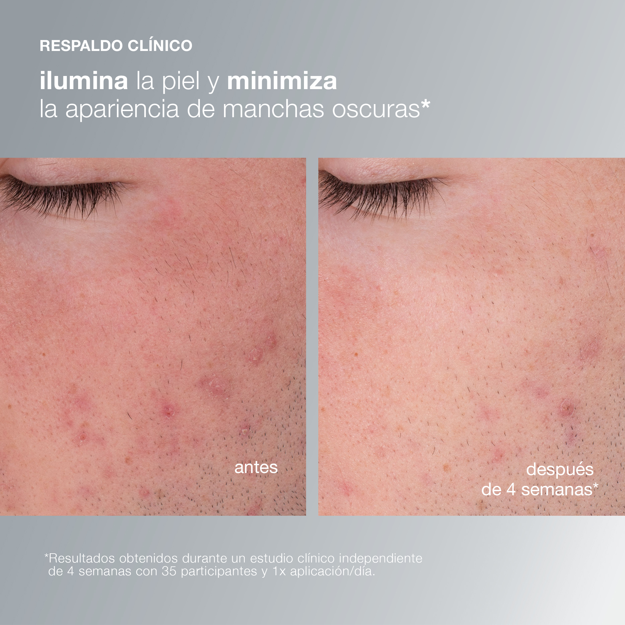 DISCOVER HEALTHY SKIN SET (SET PARA CUIDADO DE LA PIEL)