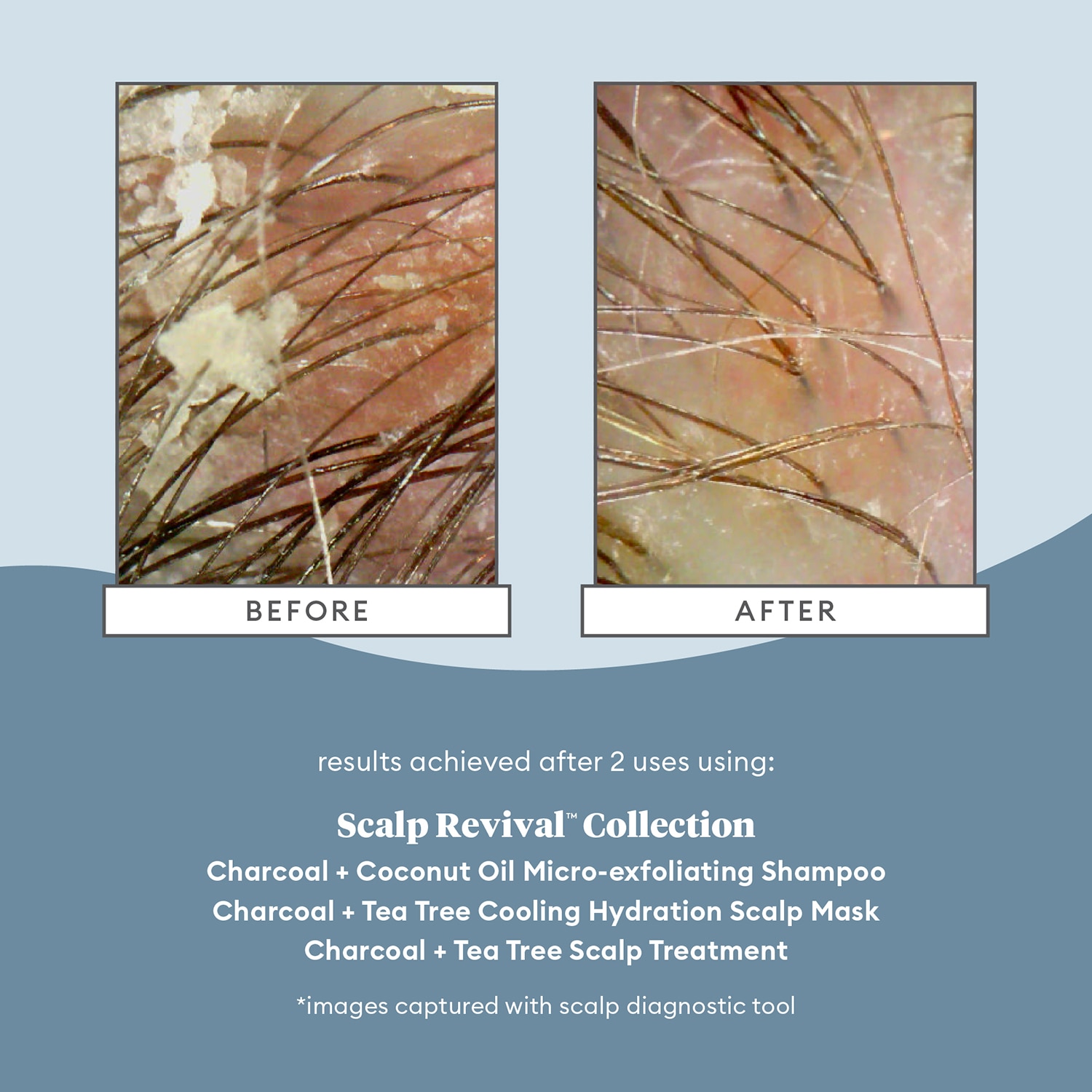 SCALP REVIVAL CHARCOAL + TEA TREE COOLING HYDRATION MASK FOR DRY, ITCHY SCALP (MASCARILLA CAPILAR HIDRATANTE)