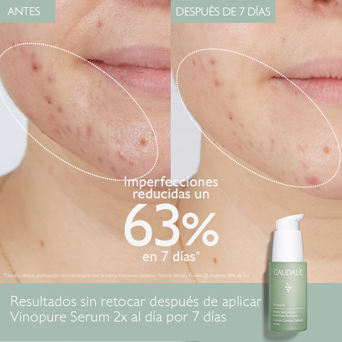 VINOPURE NATURAL SALICYLIC ACID PORE MINIMIZING SERUM