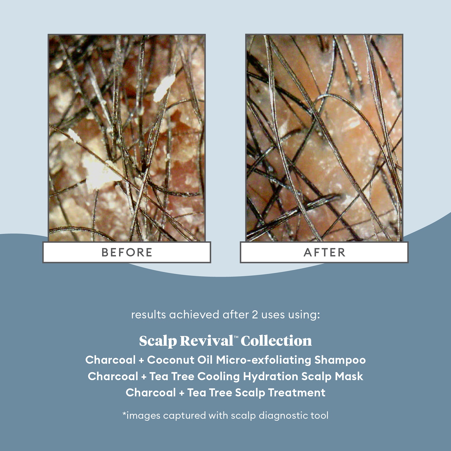 SCALP REVIVAL CHARCOAL + TEA TREE COOLING HYDRATION MASK FOR DRY, ITCHY SCALP (MASCARILLA CAPILAR HIDRATANTE)