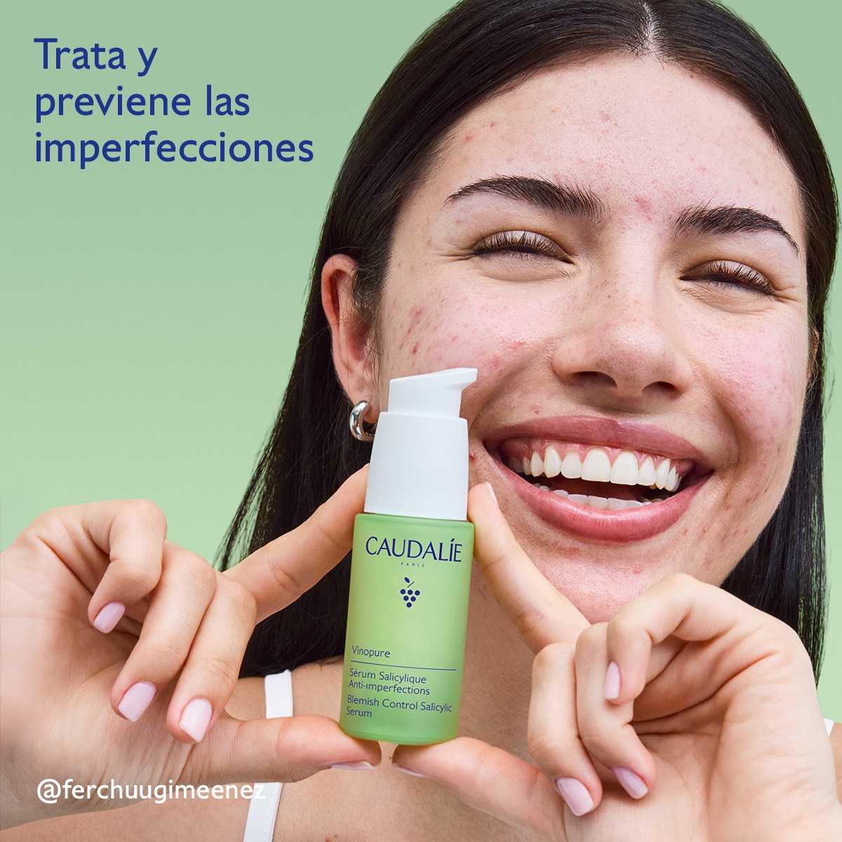VINOPURE SERUM TRATAMIENTO PARA EL ACNÉ CON ÁCIDO SALICÍLICO (TRATAMIENTO PARA EL ACNÉ)