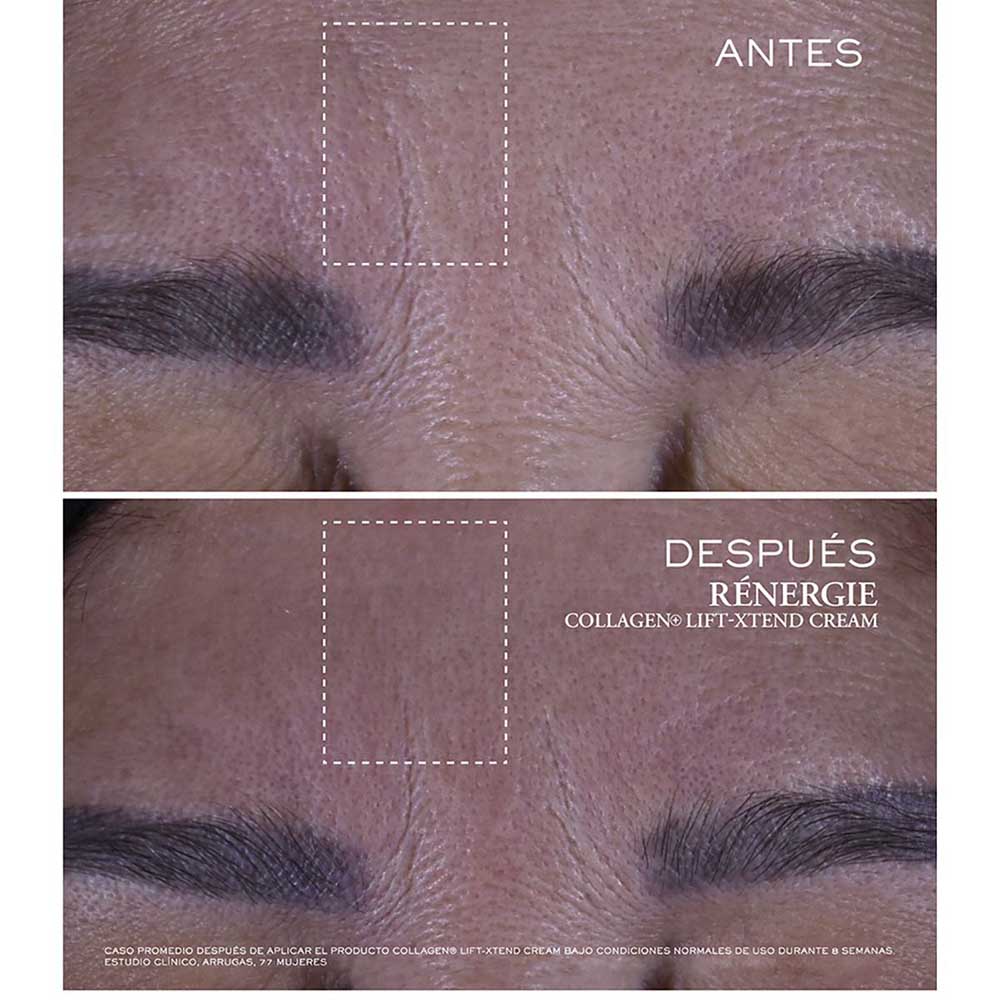 LANC&Ocirc;ME R&Eacute;NERGIE COLLAGEN+ LIFT-XTEND CREAM (CREMA CONTRA LOS SIGNOS DE LA EDAD)