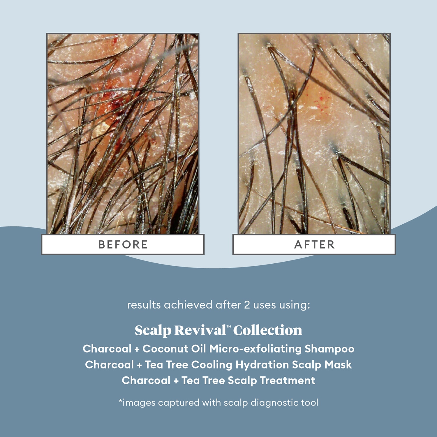 SCALP REVIVAL CHARCOAL + TEA TREE COOLING HYDRATION MASK FOR DRY, ITCHY SCALP (MASCARILLA CAPILAR HIDRATANTE)